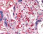 CXCL4 / PF4 Antibody